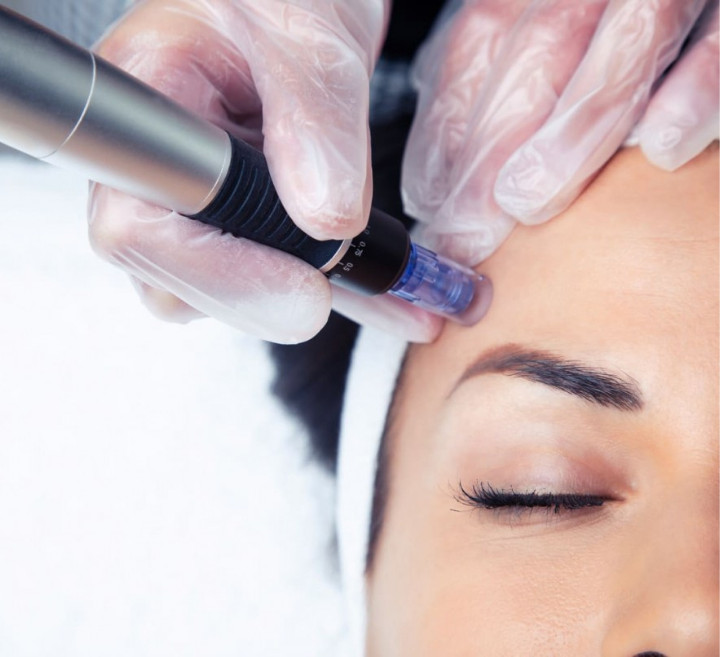 Tratamiento Dermapen Pro