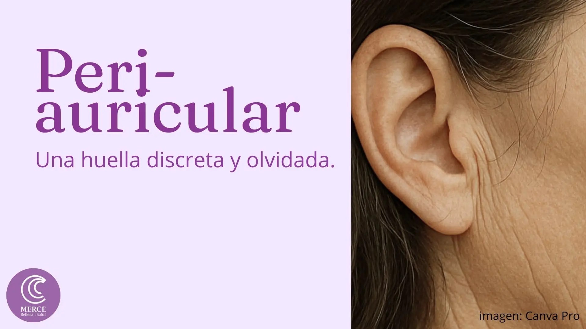 Cuso online antiarrugas Pre-auricular