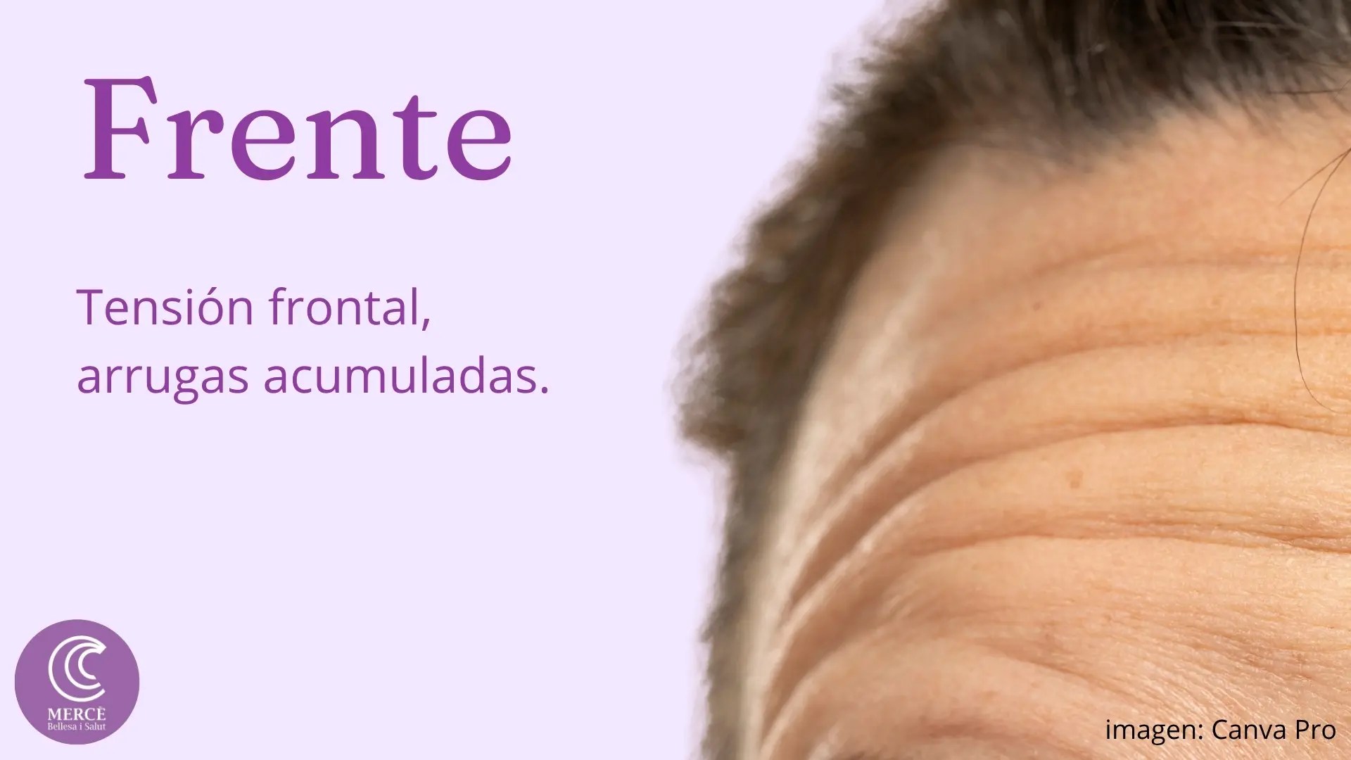 Curso online antiarrugas frente